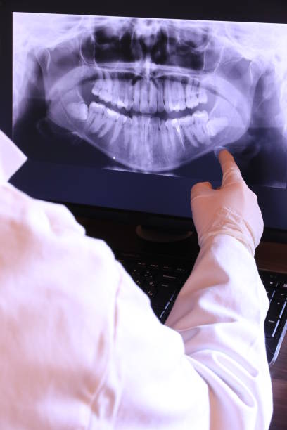 Best Emergency Dentist for Knocked-Out Tooth in Lovell, WY