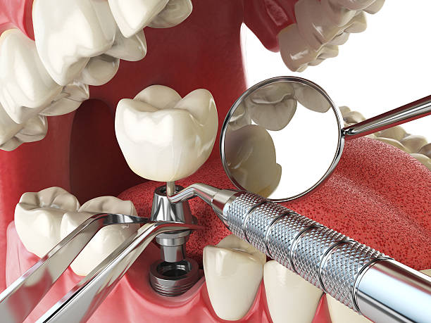 Best Emergency Dental Services for Seniors in Lovell, WY